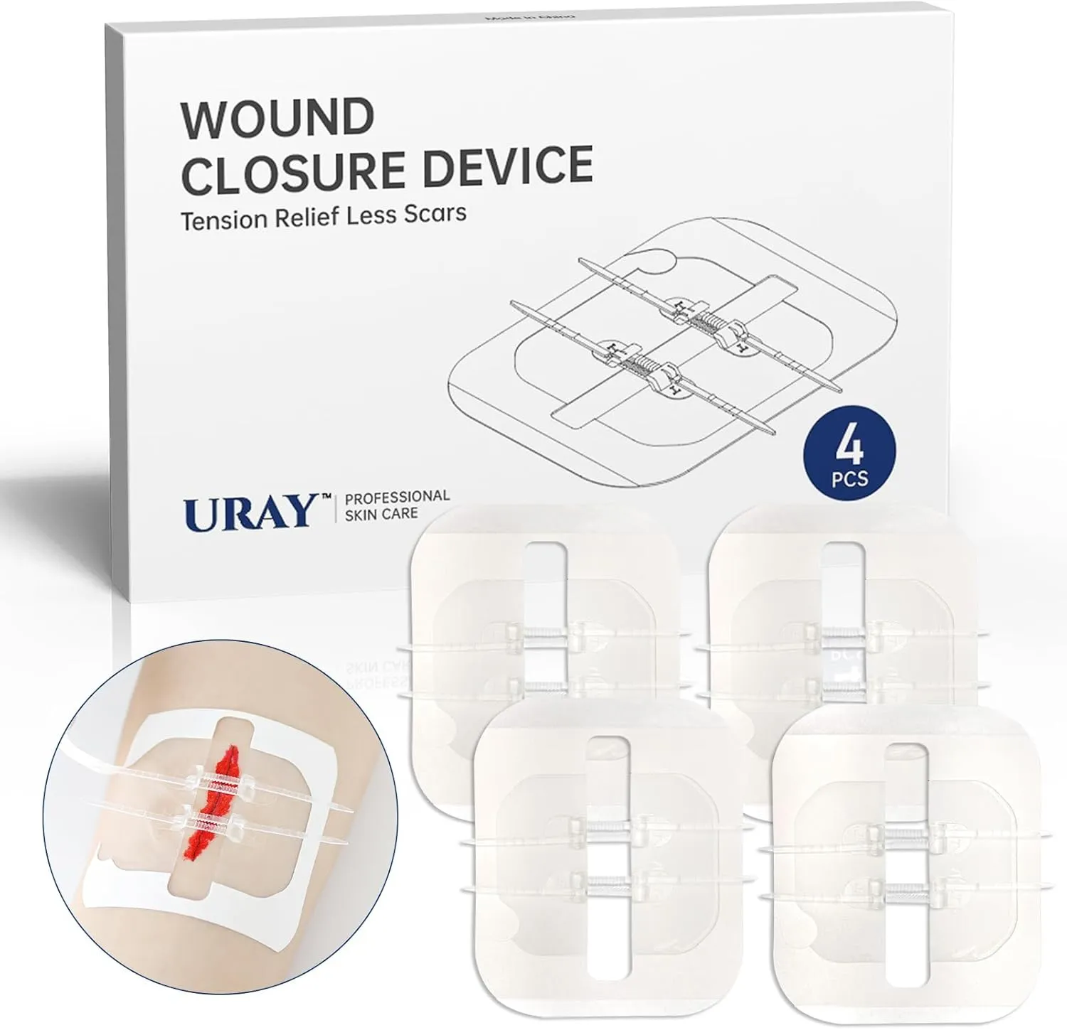 Emergency Wound Closure Device, 4 Pcs Butterfly Bandaids Closure Zippers, Repair Wounds Without Stitches, Quick Clot, Adjustable (4-Strap) (1002)