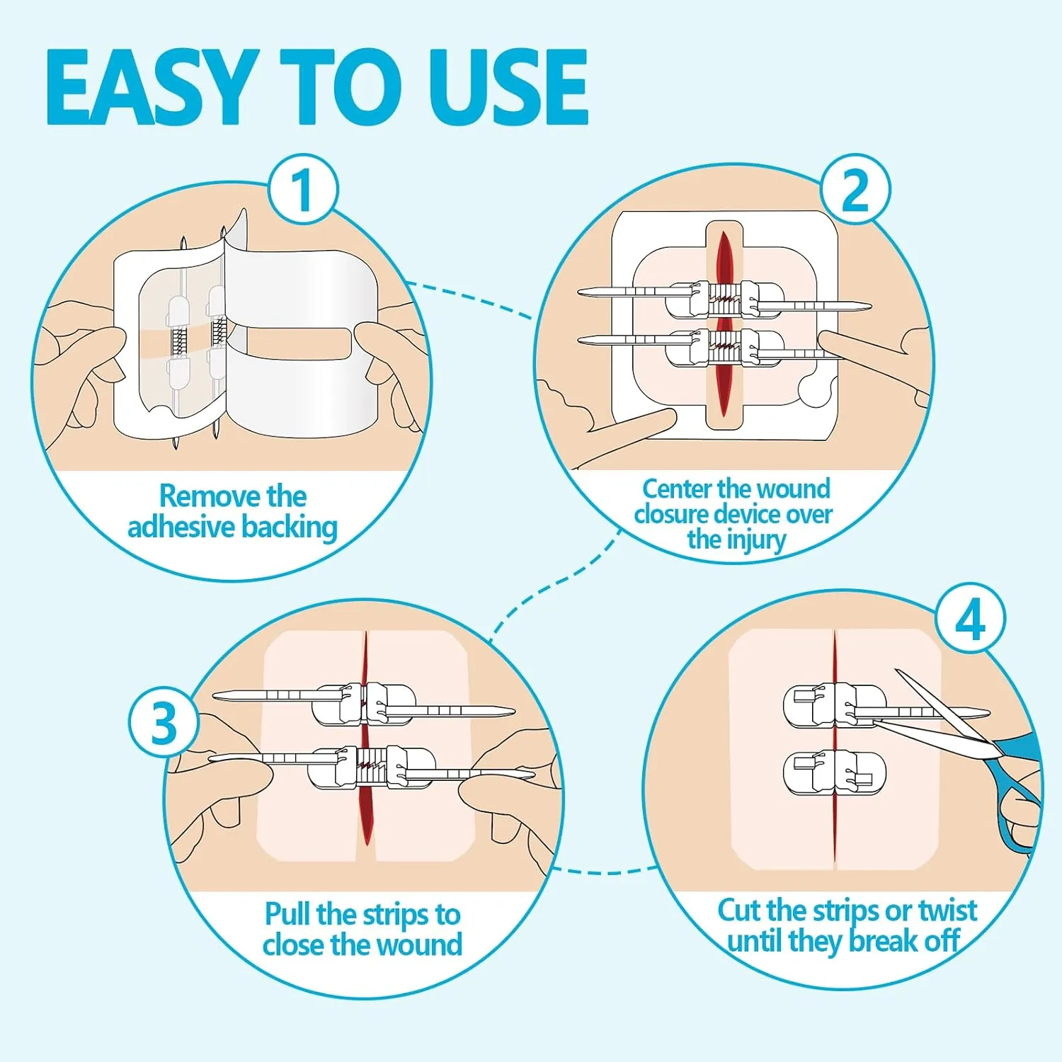 Sutures Butterfly Bandaids - 4 Pcs Laceration Kit - FSA HSA Eligible Surgical Laceration Repair Without Sew - Quick Clot -Emergency Wound Closures Device (PU)