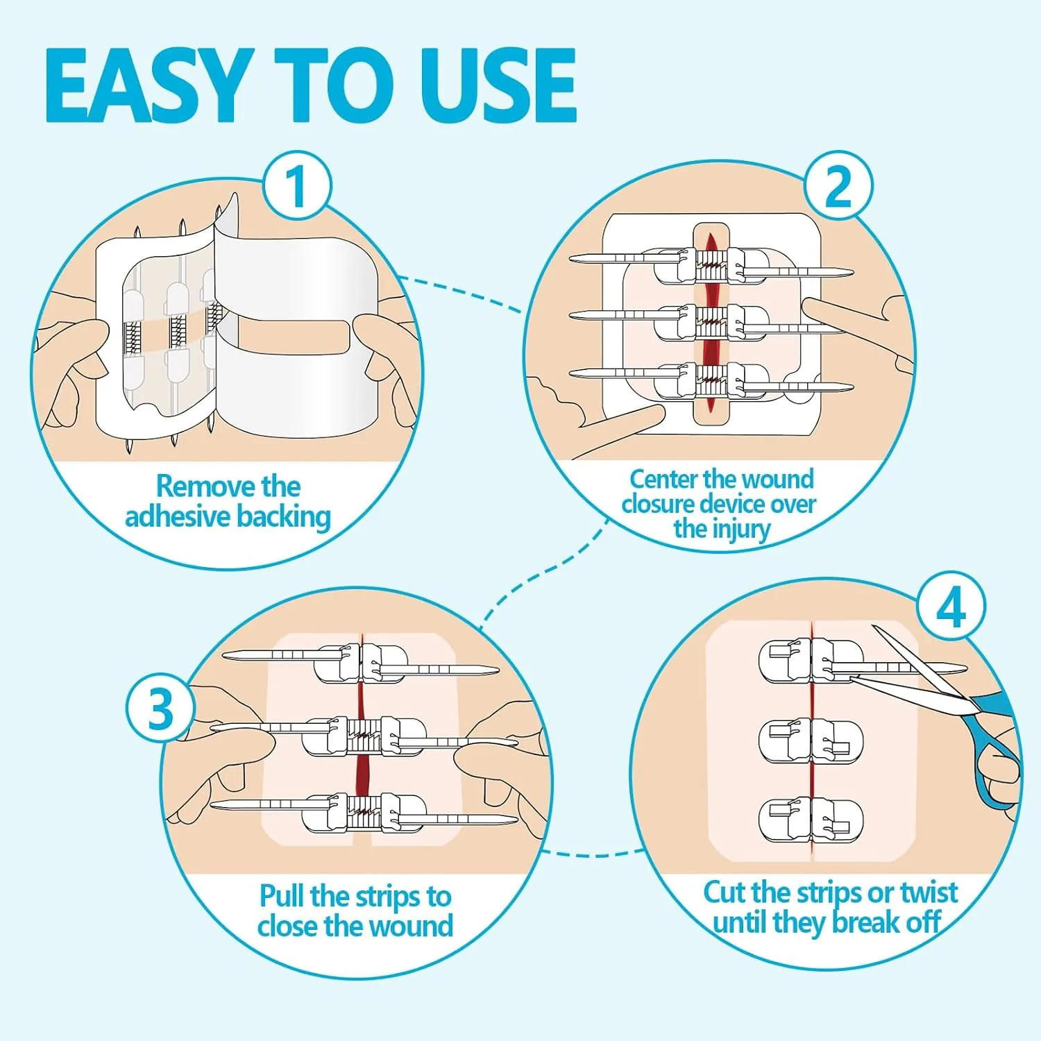 Zip Sutures Butterfly Bandaids – 4-Pack Assorted Sizes, FSA/HSA Eligible Emergency Wound Closure Kit for Surgical Laceration Repair Without Stitches, Fast Hemostasis Adhesive Strips Bandages (PU)